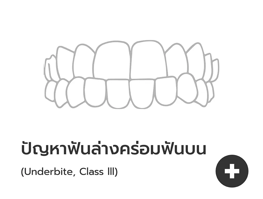 ทันตแพทย์สแกนฟันผู้เข้ารับบริการจัดฟันใสด้วยเครื่องสแกน 3D