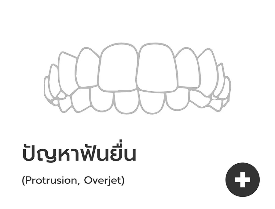 กล่องผลิตภัณฑ์จัดฟันใส Dentallight พร้อมส่งมอบ