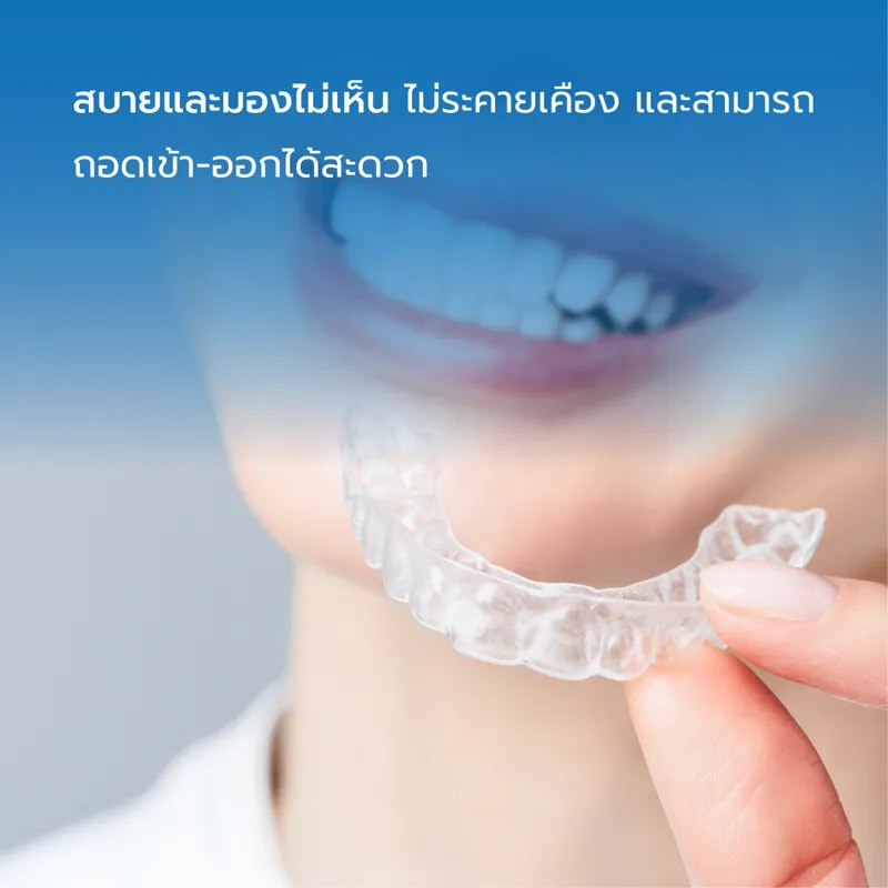 จัดฟันใสสบายและมองไม่เห็น ถอดเข้า-ออกได้สะดวก