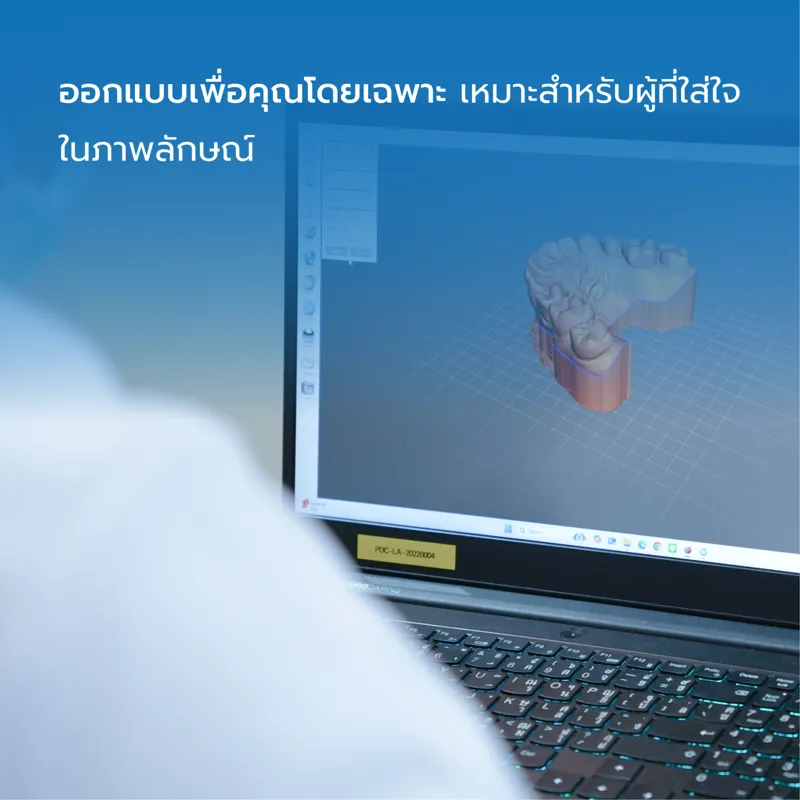 จัดฟันใสออกแบบเฉพาะบุคคลด้วยระบบดิจิทัล 3 มิติ