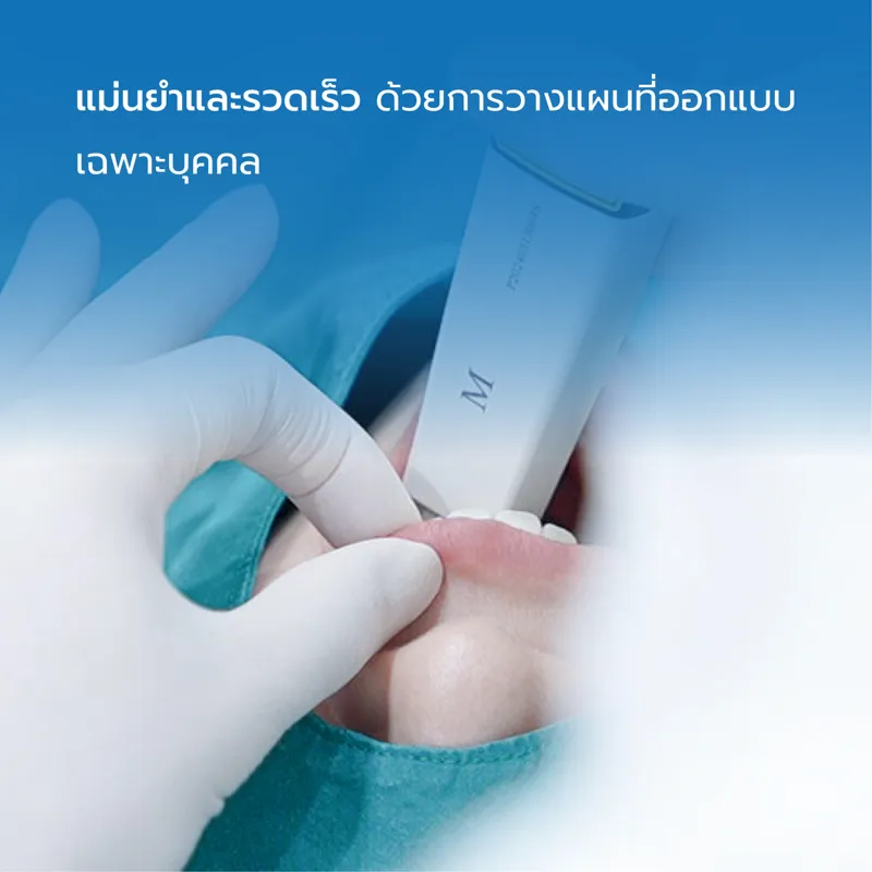จัดฟันใสแม่นยำและรวดเร็ว ด้วยการวางแผนที่ออกแบบเฉพาะบุคคล