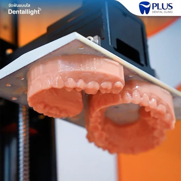 เครื่องพิมพ์ 3 มิติของแล็บ Dentallight กำลังขึ้นรูปโมเดลฟัน