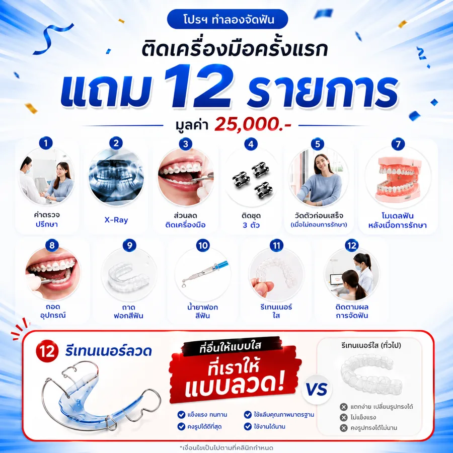 จัดฟัน 999 บาท ติดเครื่องมือจัดฟันครั้งแรก แถมฟรี 12 รายการ มูลค่า 25,000 บาท — Plus Dental Clinic